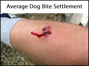 Average Dog Bite Settlement